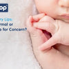 Baby Dry Lips: Is It Normal or a Cause for Concern? - hopop.in